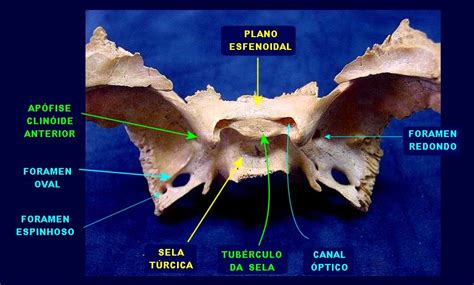 Ossos Maquina De Fenda